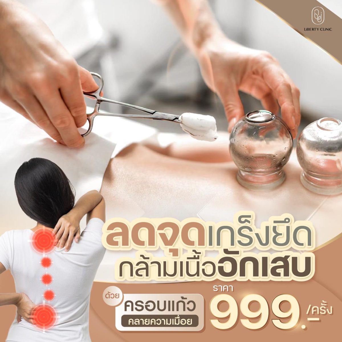 ครอบแก้ว กล้ามเนื้ออักเสบ