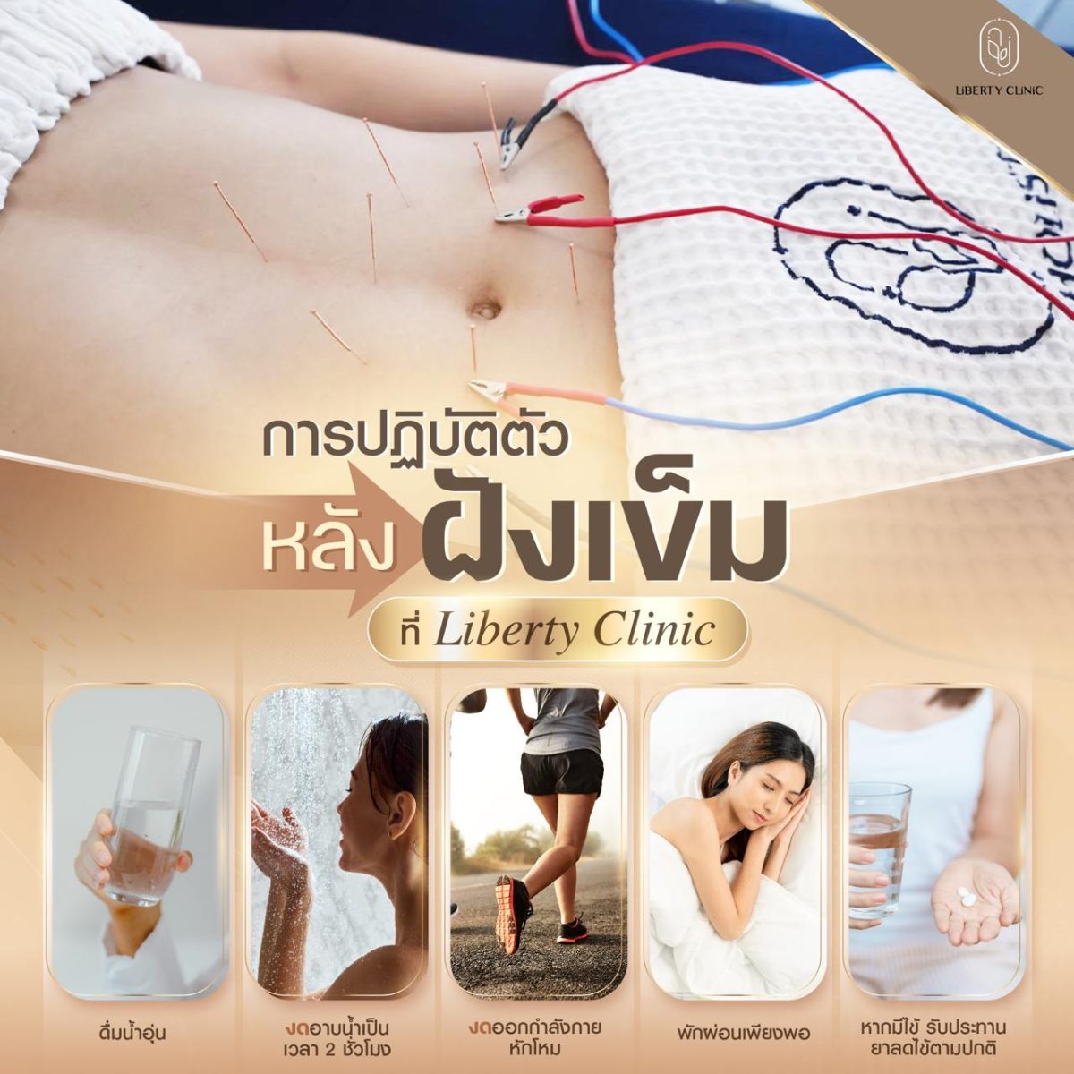 ดูแลตัวเองหลังฝังเข็ม