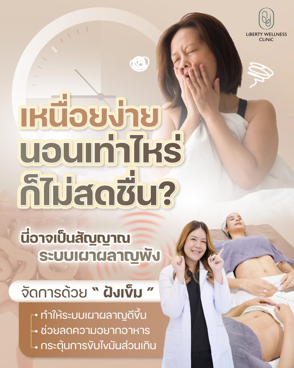 ฝังเข็มปรับสมดุล