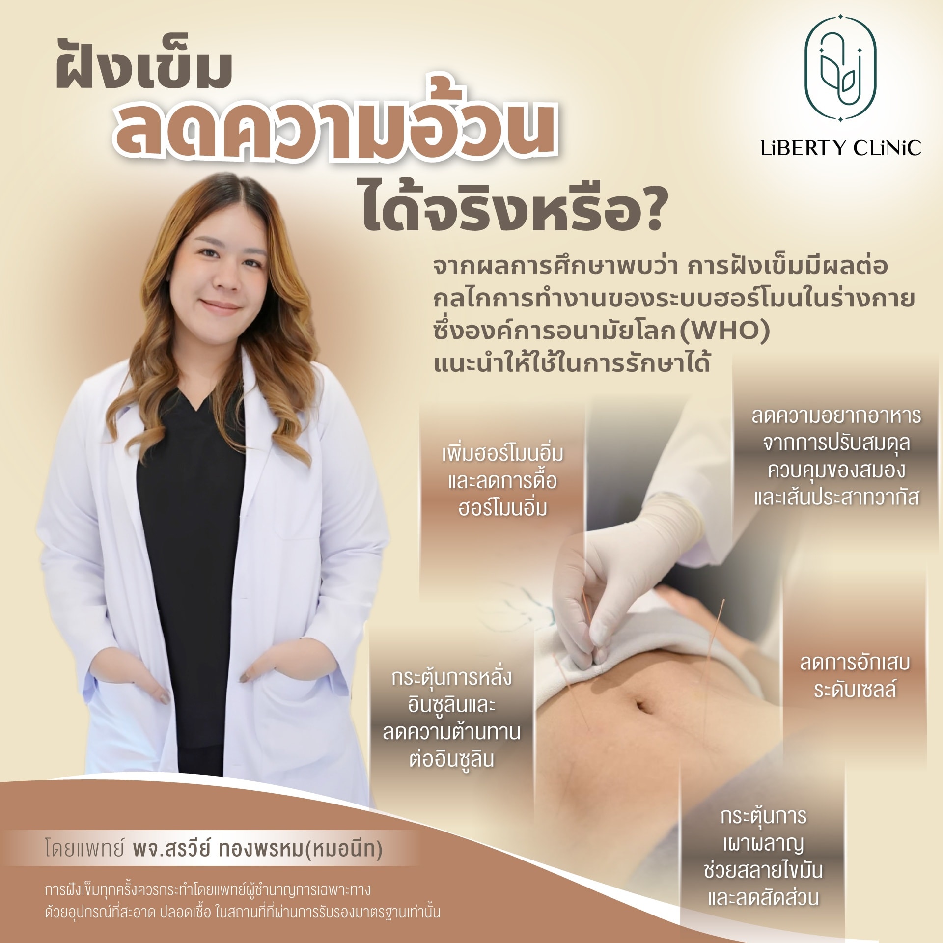 ฝังเข็มลดอ้วน
